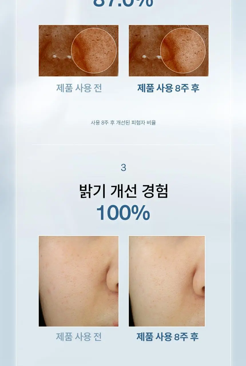 [업체배송][NEW/미백] 설화수 자정앰플세럼 30ml 기획 (자정수40ml+자정앰플세럼7ml+자정기미코렉터3ml) 상세페이지 9